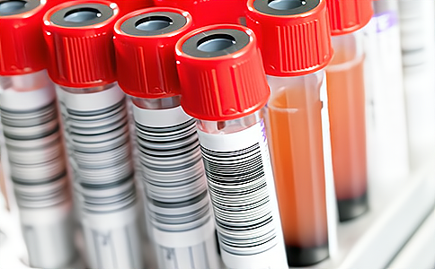 �ǻ��t(y��)��ԇ��������ӱ�������Q����